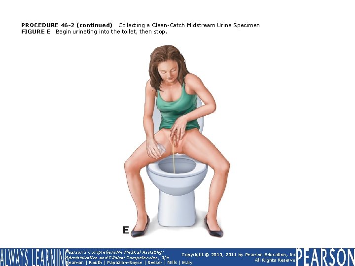 PROCEDURE 46 -2 (continued) Collecting a Clean-Catch Midstream Urine Specimen FIGURE E Begin urinating