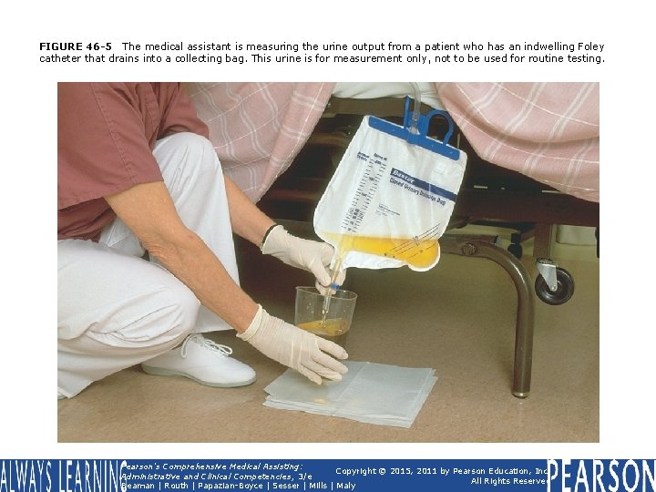 FIGURE 46 -5 The medical assistant is measuring the urine output from a patient