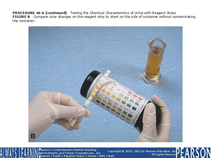 PROCEDURE 46 -6 (continued) Testing the Chemical Characteristics of Urine with Reagent Strips FIGURE