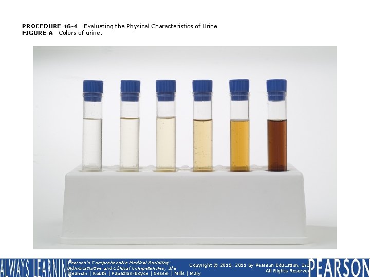 PROCEDURE 46 -4 Evaluating the Physical Characteristics of Urine FIGURE A Colors of urine.