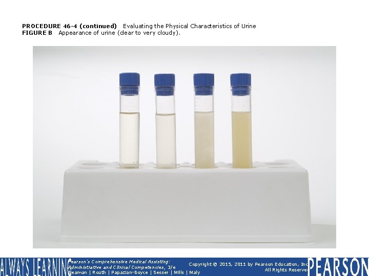 PROCEDURE 46 -4 (continued) Evaluating the Physical Characteristics of Urine FIGURE B Appearance of