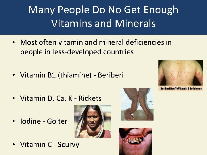 Many People Do No Get Enough Vitamins and Minerals • Most often vitamin and