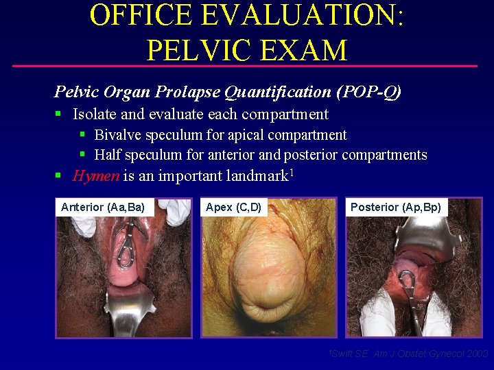 OFFICE EVALUATION: PELVIC EXAM Pelvic Organ Prolapse Quantification (POP-Q) § Isolate and evaluate each