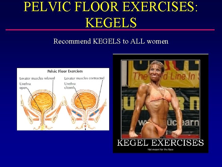PELVIC FLOOR EXERCISES: KEGELS Recommend KEGELS to ALL women 