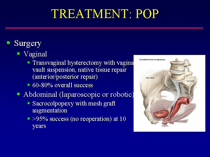 TREATMENT: POP § Surgery § Vaginal § Transvaginal hysterectomy with vaginal vault suspension, native