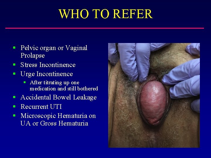 WHO TO REFER § Pelvic organ or Vaginal Prolapse § Stress Incontinence § Urge