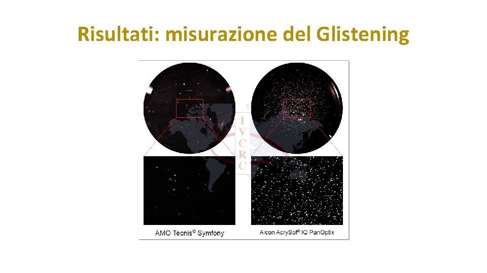 Risultati: misurazione del Glistening 