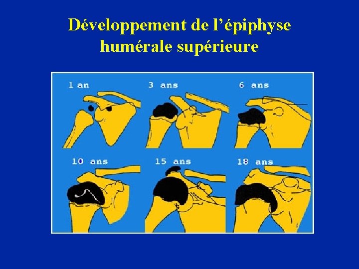 Développement de l’épiphyse humérale supérieure 