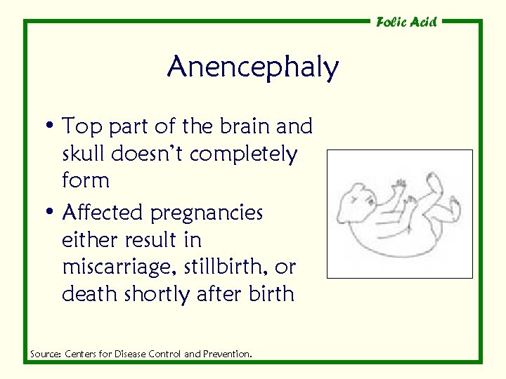 Folic Acid Anencephaly • Top part of the brain and skull doesn’t completely form