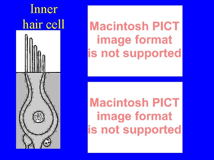 Inner hair cell 