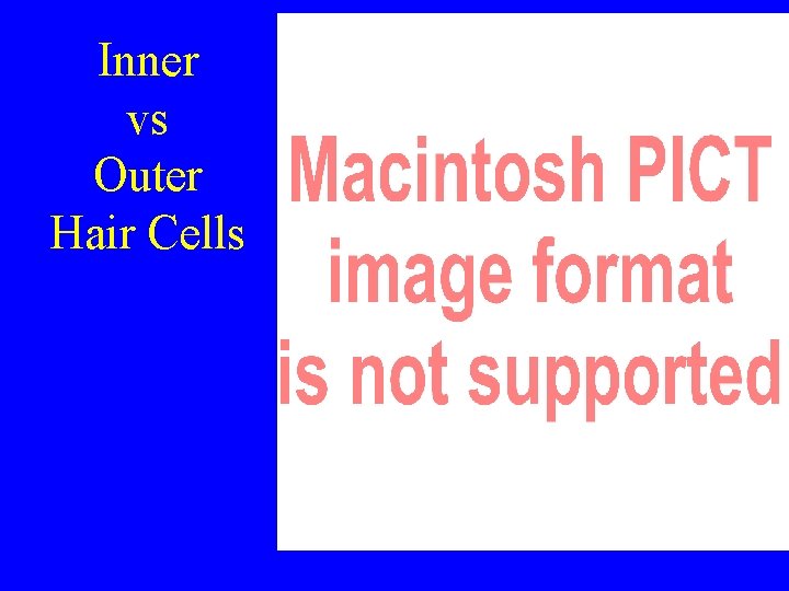 Inner vs Outer Hair Cells 