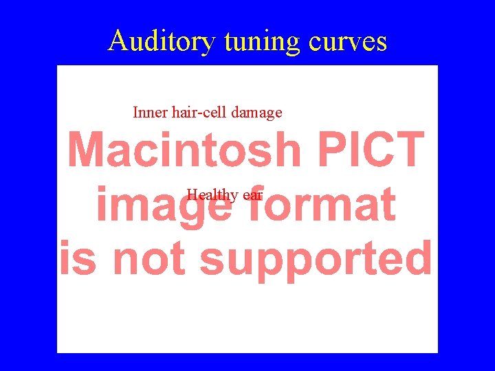 Auditory tuning curves Inner hair-cell damage Healthy ear 