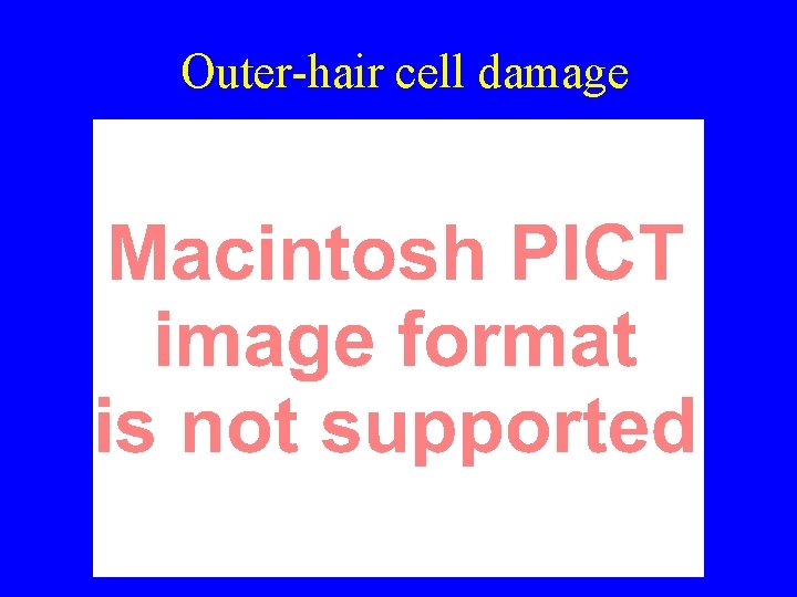 Outer-hair cell damage 