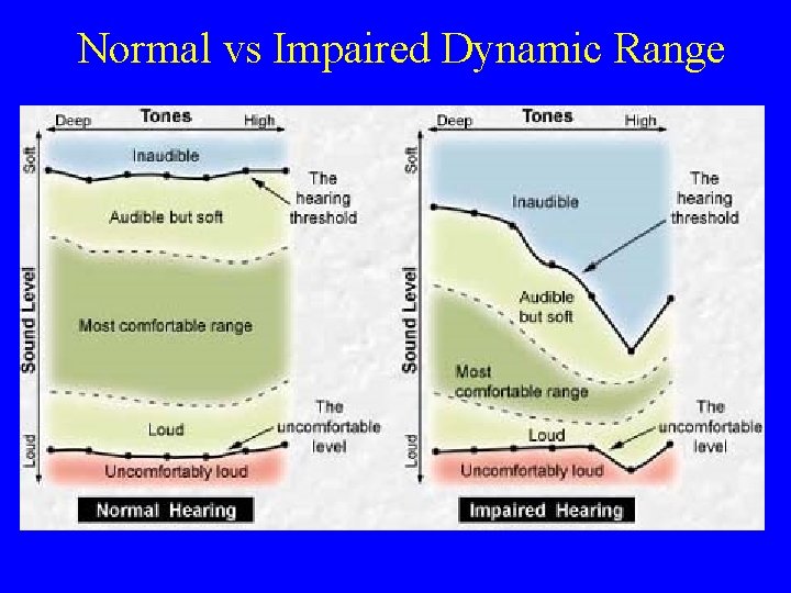 Normal vs Impaired Dynamic Range 