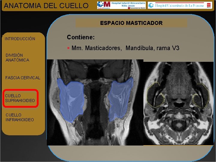 ANATOMIA DEL CUELLO ESPACIO MASTICADOR INTRODUCCIÓN Contiene: § Mm. Masticadores, Mandíbula, rama V 3