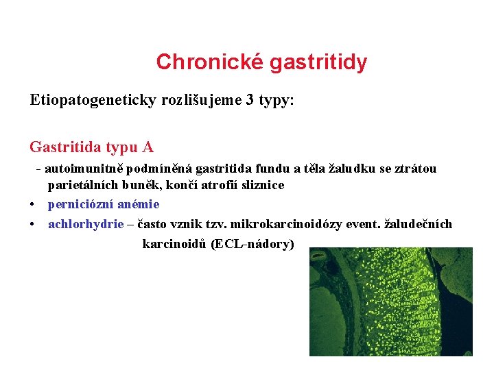 Chronické gastritidy Etiopatogeneticky rozlišujeme 3 typy: Gastritida typu A - autoimunitně podmíněná gastritida fundu