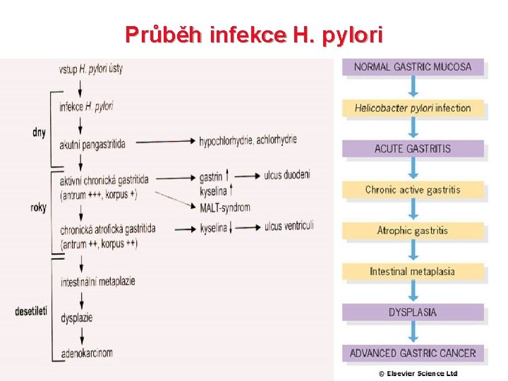 Průběh infekce H. pylori 
