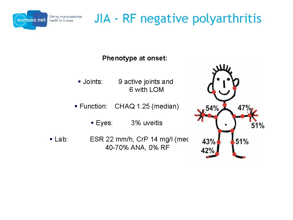 JIA - RF negative polyarthritis Phenotype at onset: § Joints: 9 active joints and