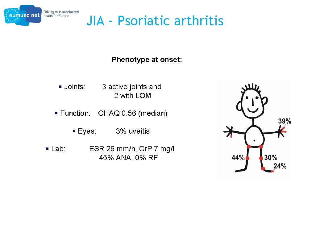 JIA - Psoriatic arthritis Phenotype at onset: § Joints: 3 active joints and 2