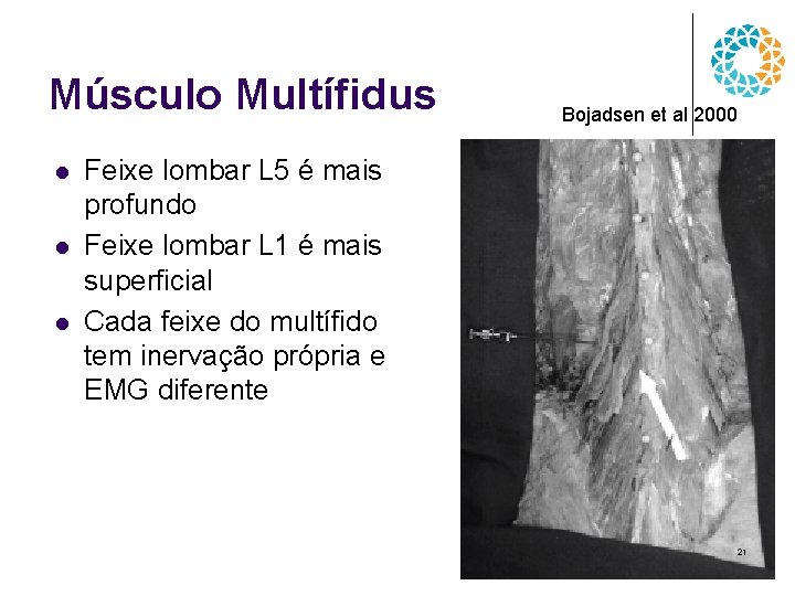 Músculo Multífidus l l l Bojadsen et al 2000 Feixe lombar L 5 é