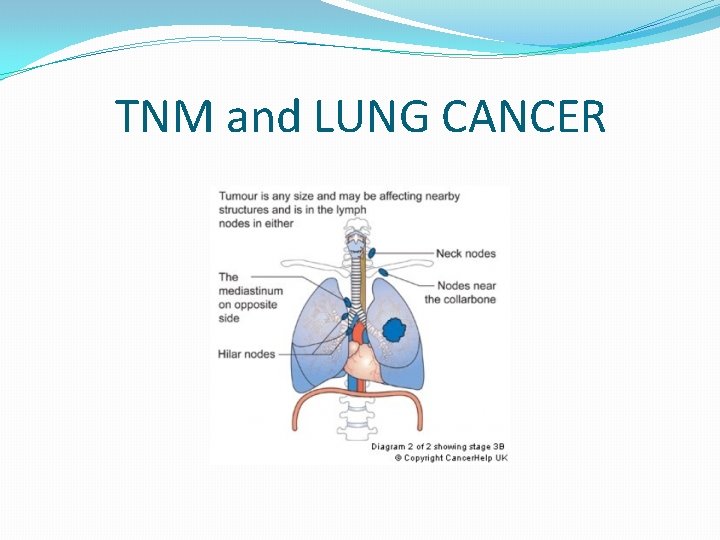 TNM and LUNG CANCER 