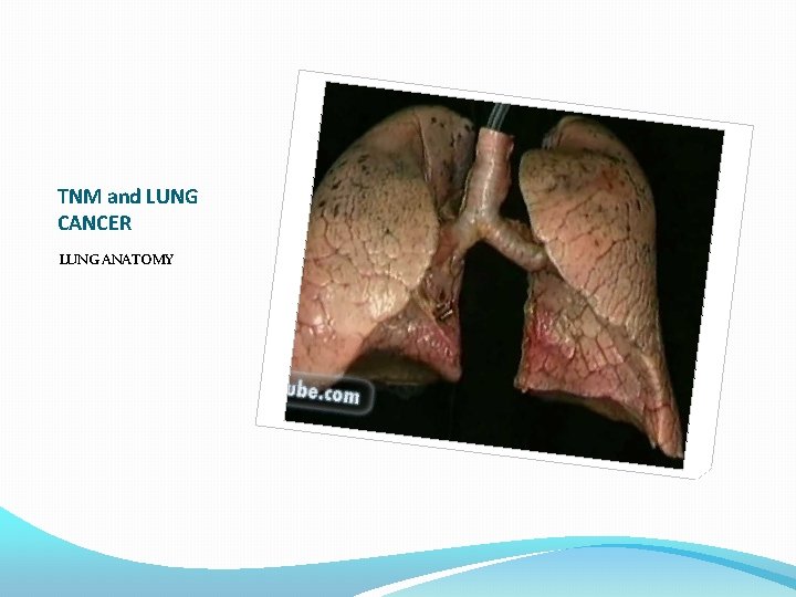 TNM and LUNG CANCER LUNG ANATOMY 