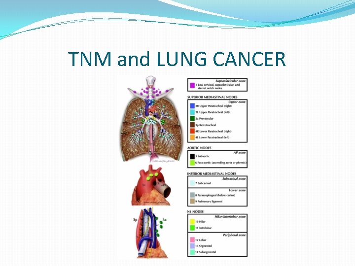 TNM and LUNG CANCER 