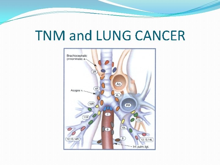 TNM and LUNG CANCER 