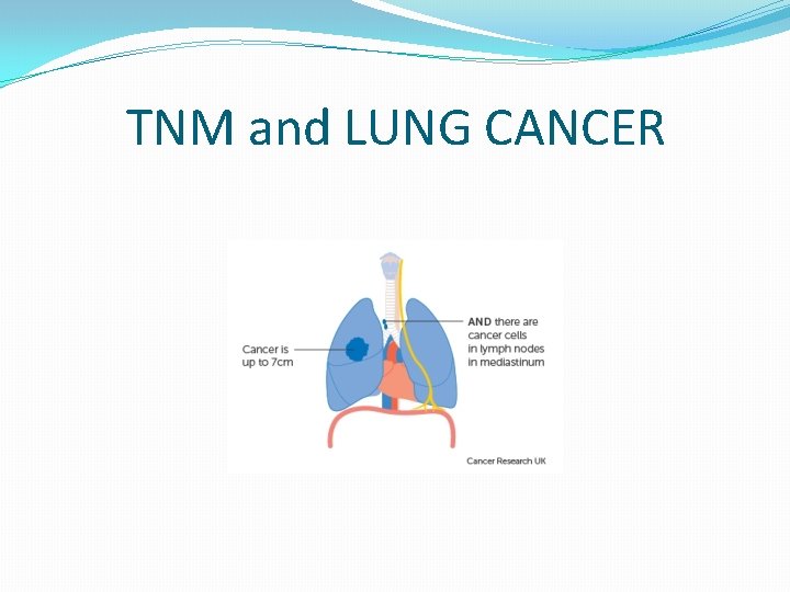 TNM and LUNG CANCER 