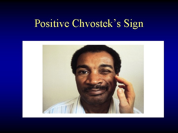 Positive Chvostek’s Sign 