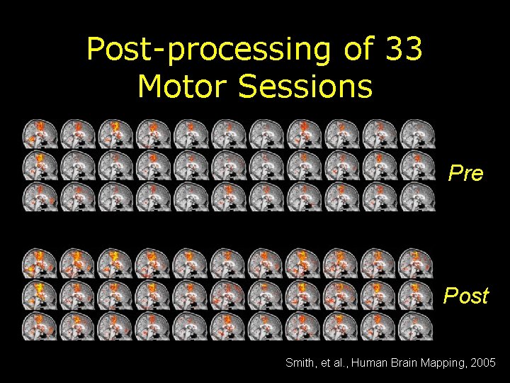 Post-processing of 33 Motor Sessions Pre Post Smith, et al. , Human Brain Mapping,