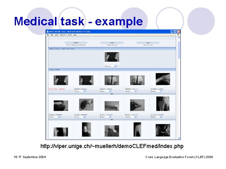Medical task - example http: //viper. unige. ch/~muellerh/demo. CLEFmed/index. php 15 -17 September 2004