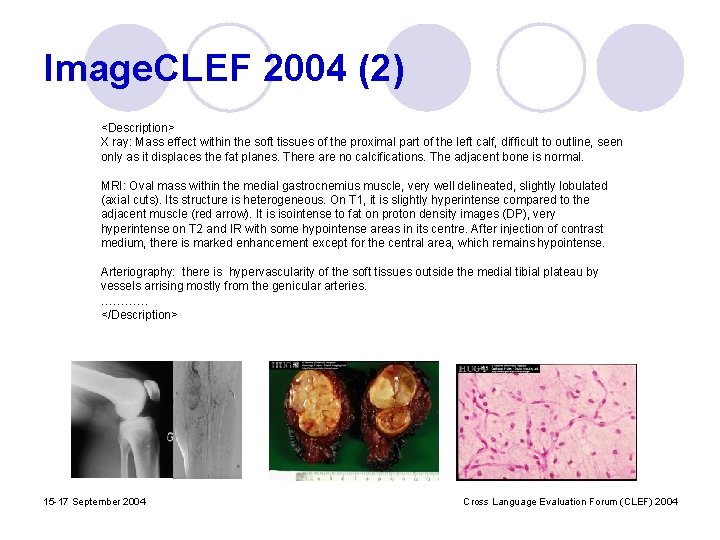 Image. CLEF 2004 (2) <Description> X ray: Mass effect within the soft tissues of