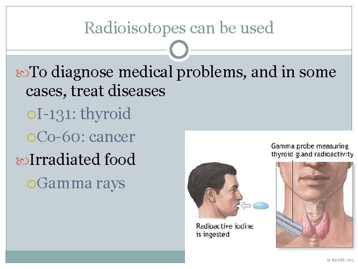 Radioisotopes can be used To diagnose medical problems, and in some cases, treat diseases