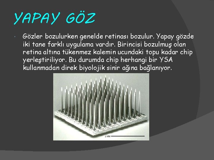 YAPAY GÖZ Gözler bozulurken genelde retinası bozulur. Yapay gözde iki tane farklı uygulama vardır.