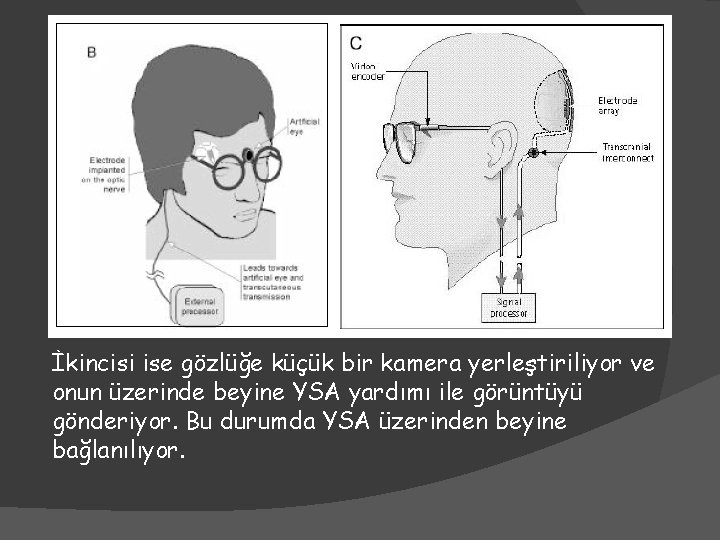 İkincisi ise gözlüğe küçük bir kamera yerleştiriliyor ve onun üzerinde beyine YSA yardımı ile