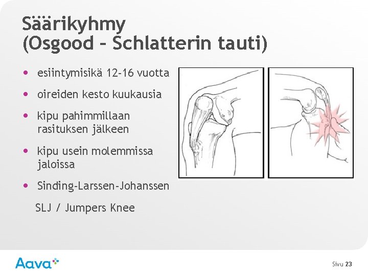 Säärikyhmy (Osgood – Schlatterin tauti) • esiintymisikä 12 -16 vuotta • oireiden kesto kuukausia