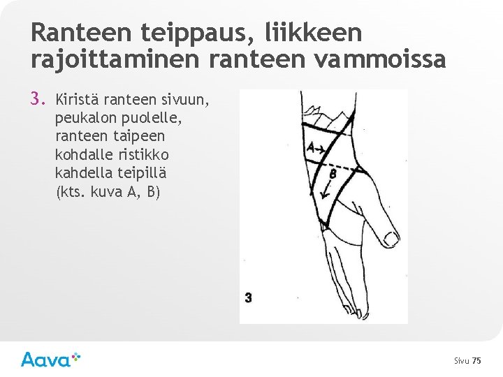 Ranteen teippaus, liikkeen rajoittaminen ranteen vammoissa 3. Kiristä ranteen sivuun, peukalon puolelle, ranteen taipeen