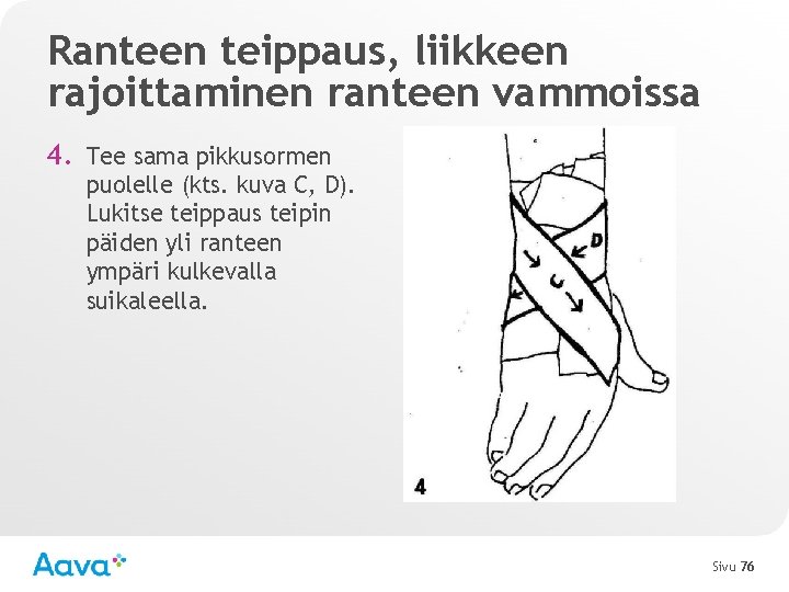 Ranteen teippaus, liikkeen rajoittaminen ranteen vammoissa 4. Tee sama pikkusormen puolelle (kts. kuva C,