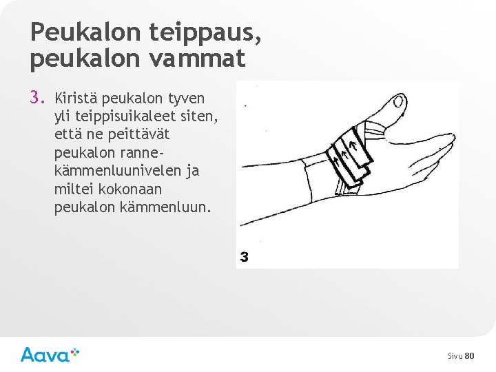 Peukalon teippaus, peukalon vammat 3. Kiristä peukalon tyven yli teippisuikaleet siten, että ne peittävät