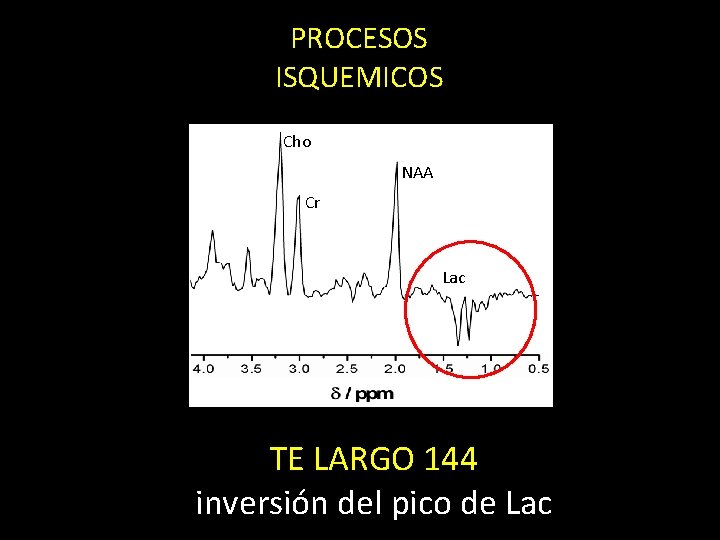 PROCESOS ISQUEMICOS Cho NAA Cr Lac TE LARGO 144 inversión del pico de Lac