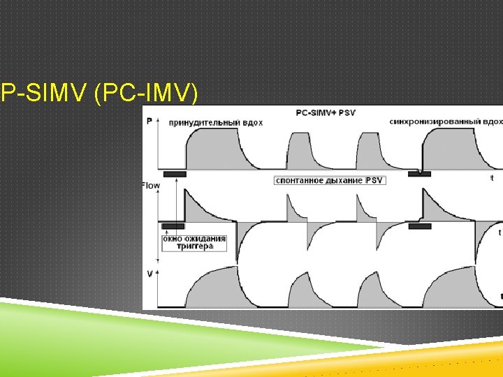 P-SIMV (PC-IMV) 
