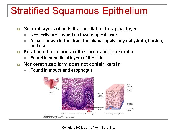 Stratified Squamous Epithelium q Several layers of cells that are flat in the apical