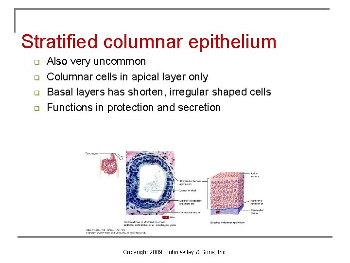Stratified columnar epithelium q q Also very uncommon Columnar cells in apical layer only