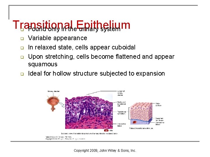 Transitional Found only in the. Epithelium urinary system q q q Variable appearance In