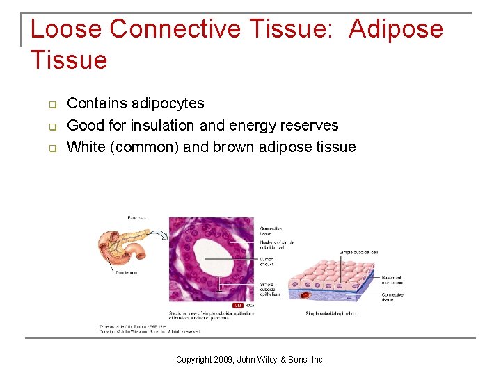Loose Connective Tissue: Adipose Tissue q q q Contains adipocytes Good for insulation and