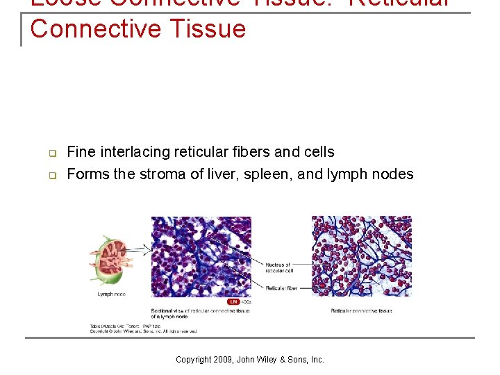 Loose Connective Tissue: Reticular Connective Tissue q q Fine interlacing reticular fibers and cells