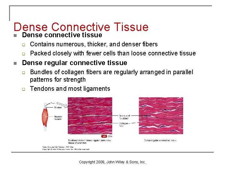 Dense Connective Tissue n Dense connective tissue q q n Contains numerous, thicker, and