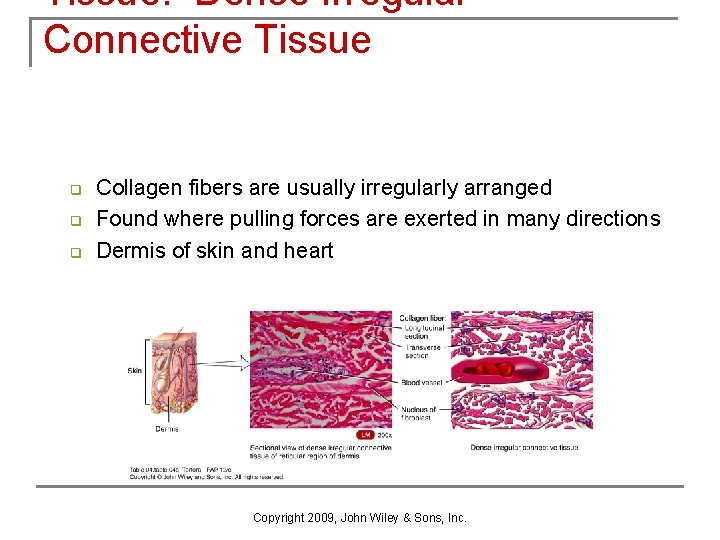 Tissue: Dense Irregular Connective Tissue q q q Collagen fibers are usually irregularly arranged