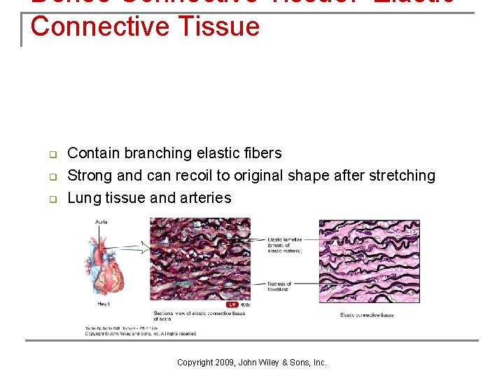 Dense Connective Tissue: Elastic Connective Tissue q q q Contain branching elastic fibers Strong